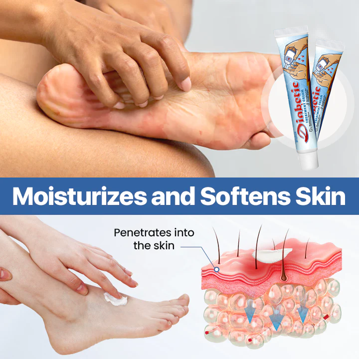 Blizkox® VitaGluco Diabetes Treatment Cream ✅ Heal Diabetic Wounds Faster, Safer, and More Effectively.