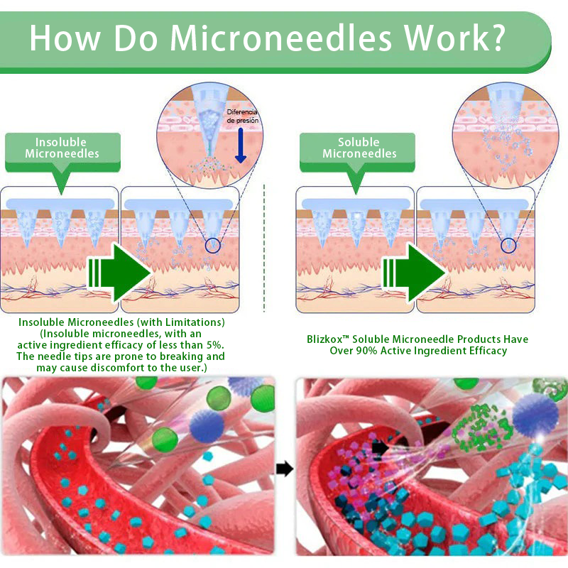 【New Product Last Minute! 80% OFF】Blizkox® NIDDK-Tirzepatide Nano Patch 🇺🇸⚕️ (Painless 24/7 Fat Burning | Lose 20 Pounds in Weeks | Crush Cravings Fast!
