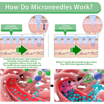 【New Product Last Minute! 80% OFF】Blizkox® NIDDK-Tirzepatide Nano Patch 🇺🇸⚕️ (Painless 24/7 Fat Burning | Lose 20 Pounds in Weeks | Crush Cravings Fast!